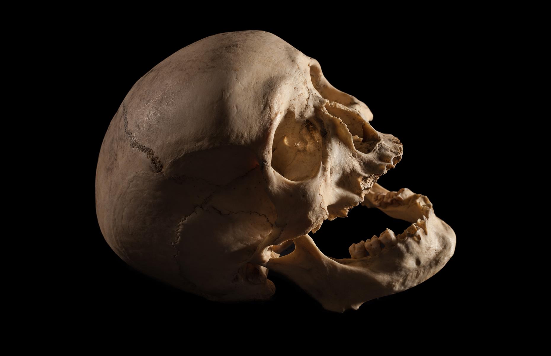 A human skull
